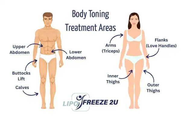 Graphic showing where you can have Body toning Treatment Potters Bar on your body