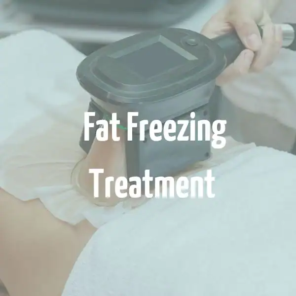 fat freezing treatment Potters Bar