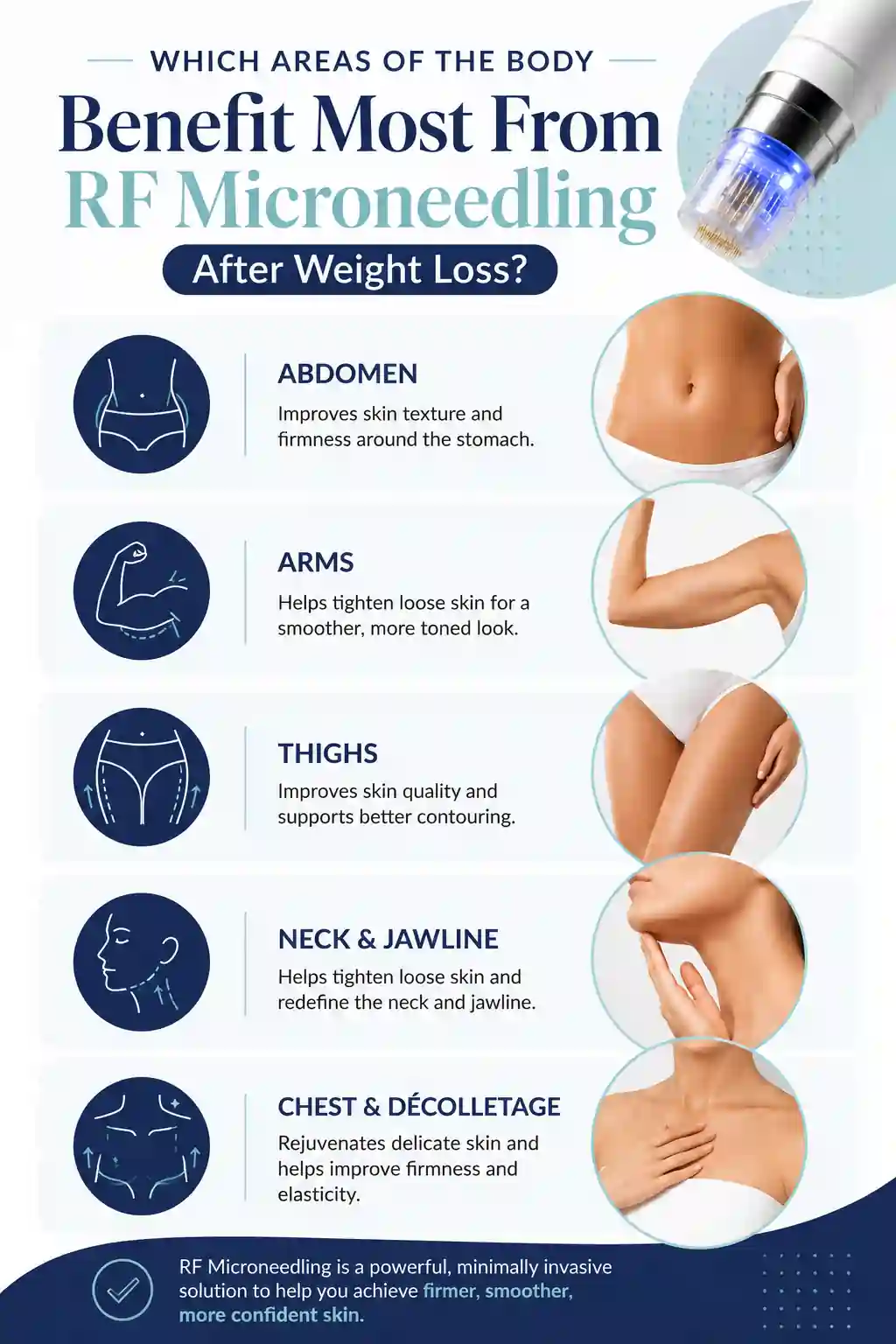 Which Areas of the Body Benefit Most From RF Microneedling After Weight Loss Potters Bar